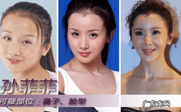整形上瘾的女明星 整形过的明星