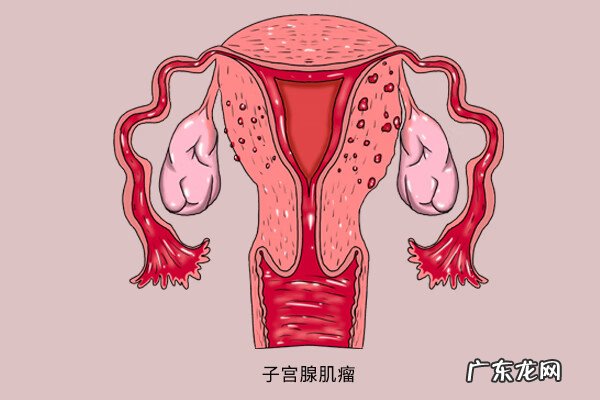 小腹剧烈疼痛是什么原因 月经小腹疼痛的原因