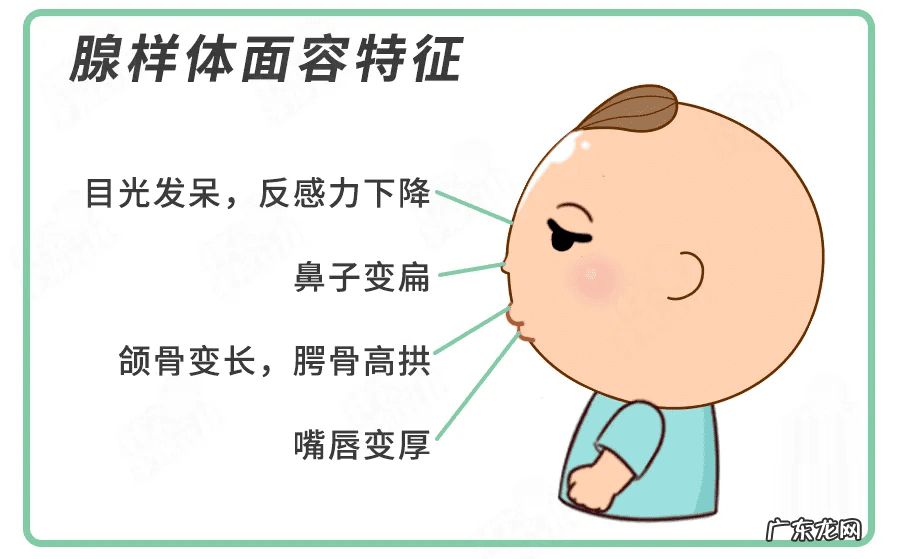 儿童腺样体肥大怎么引起的 鼻子腺体肥大是什么症状小孩怎么治疗