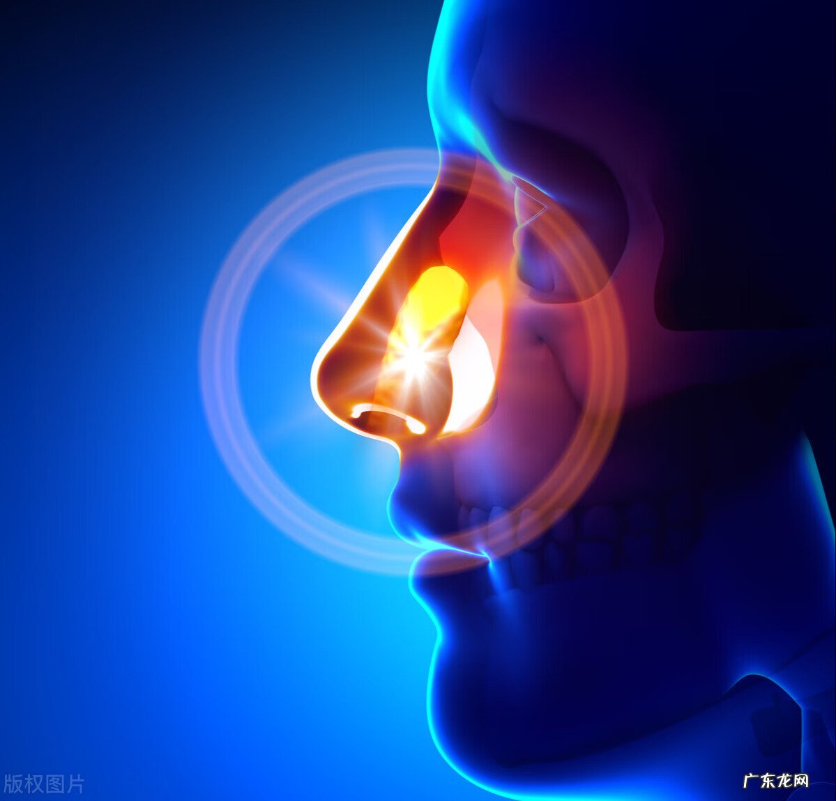 鼻窦炎需要怎么治疗 鼻窦炎的治疗方法有哪些