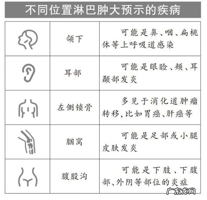 淋巴结肿大是什么原因引起 淋巴结肿大的原因及表现