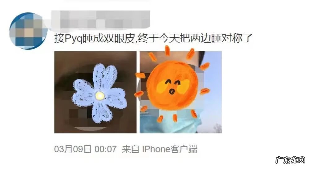 双眼皮怎样变单眼皮图片 单眼皮变双眼皮图片大全