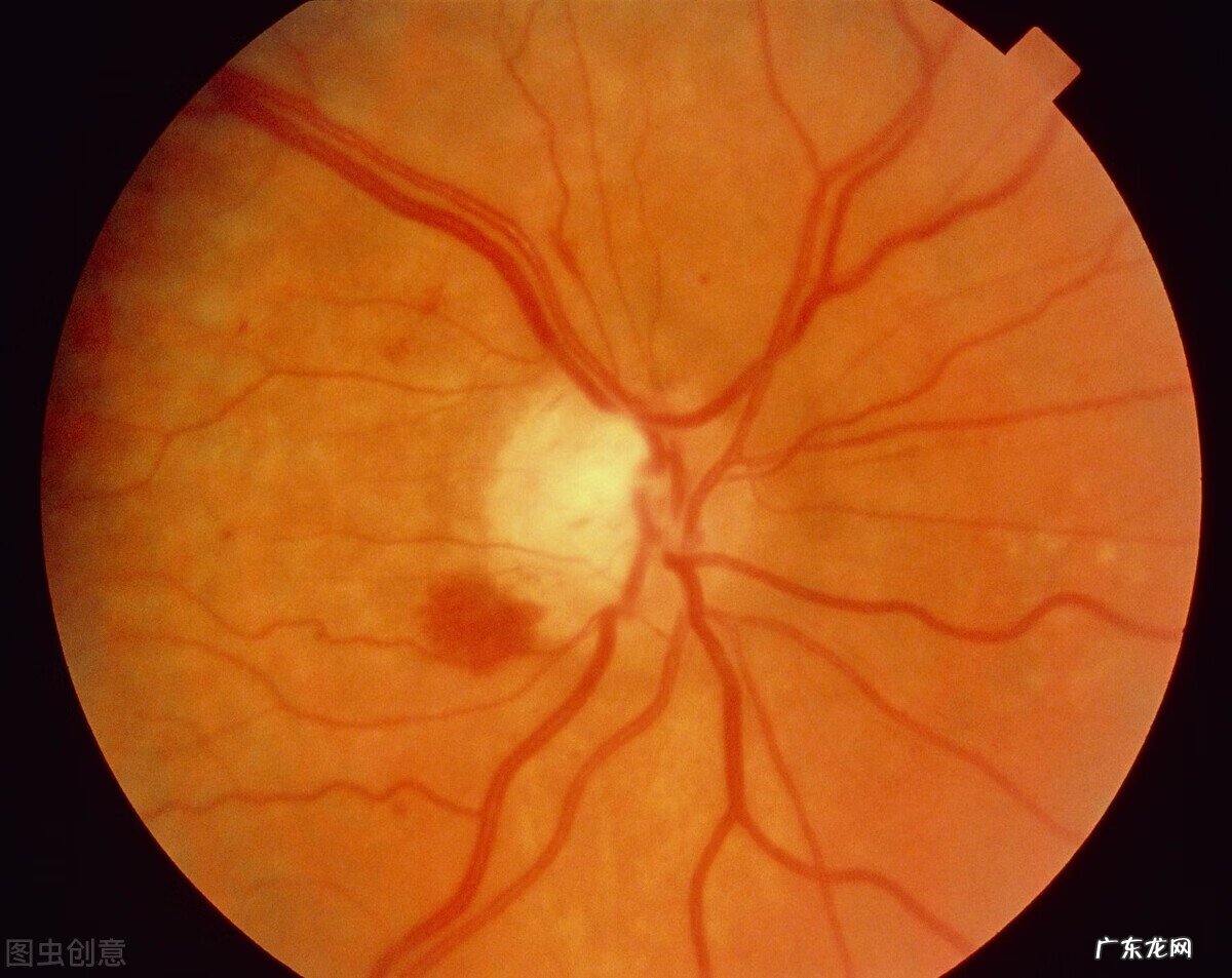 眼病有哪些 眼部疾病有哪些