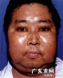 颈纹的风水 颈纹风水面相