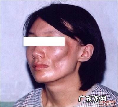 颈纹的风水 颈纹风水面相