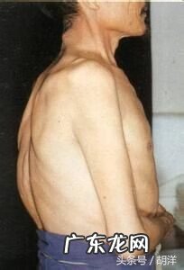 颈纹的风水 颈纹风水面相