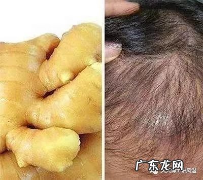 拿生姜擦头皮 生姜擦头皮真的能生发吗