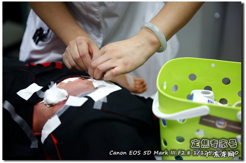 面部长红斑是怎么回事 什么是面部红斑