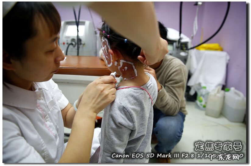 面部长红斑是怎么回事 什么是面部红斑