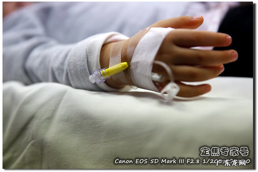 面部长红斑是怎么回事 什么是面部红斑