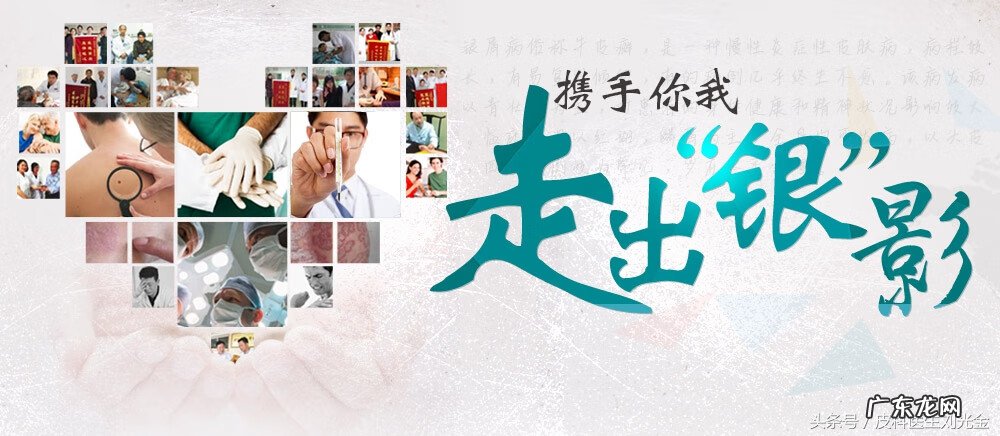 银屑病大多数人会自愈 脓疱型银屑病传染吗