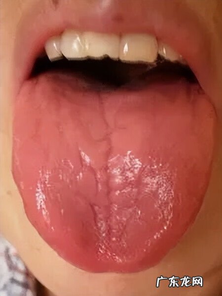 舌头上有好多红点点是什么原因 舌头有红点点