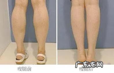 怎么减小腿上的肥肉 怎么减小腿肚子