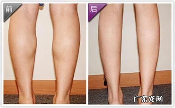 怎么减小腿上的肥肉 怎么减小腿肚子