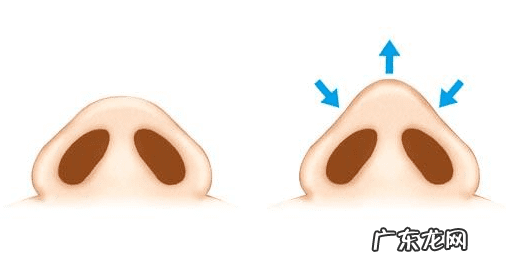 女的鼻头变大说明什么风水 鼻头变大什么原因风水