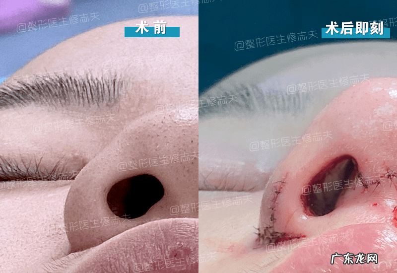 女的鼻头变大说明什么风水 鼻头变大什么原因风水