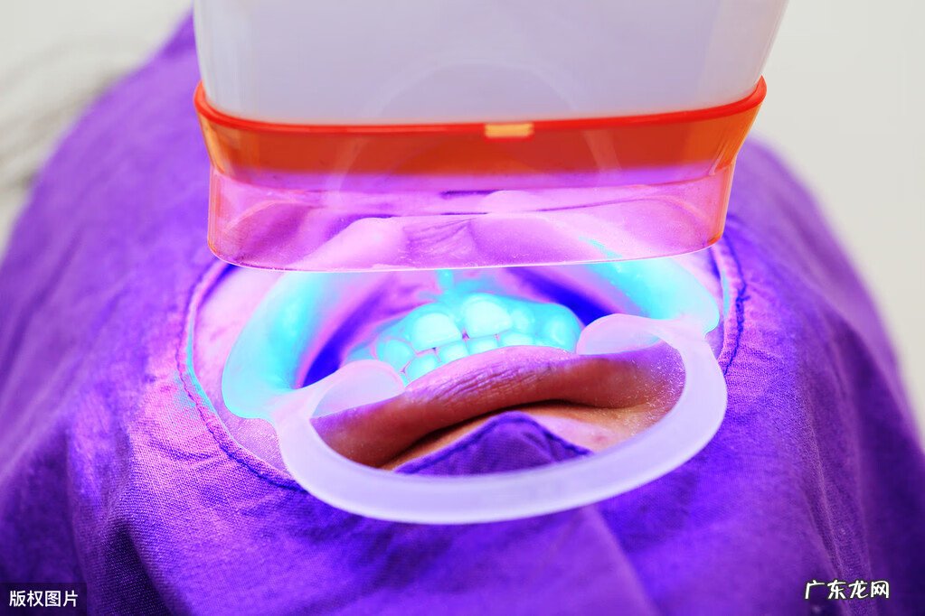 洁白牙齿一般多少钱 陶瓷美白牙齿多少钱