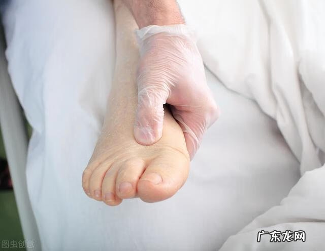 尖锐湿疹疣治疗方法 治疗疣湿的治疗方法