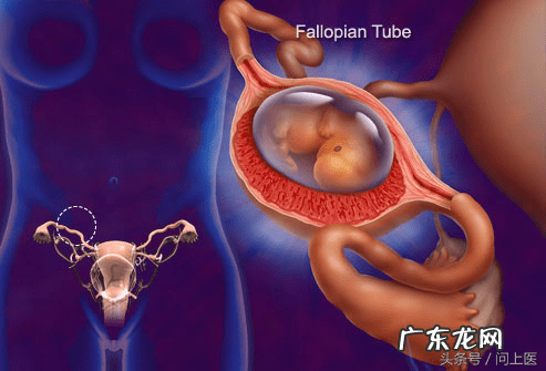 下腹盆腔坠痛 盆腔坠痛恶心