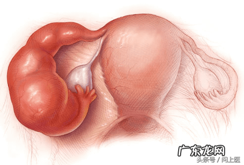 下腹盆腔坠痛 盆腔坠痛恶心