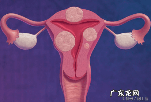 下腹盆腔坠痛 盆腔坠痛恶心