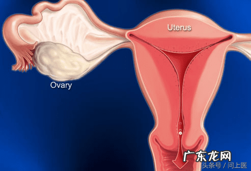 下腹盆腔坠痛 盆腔坠痛恶心