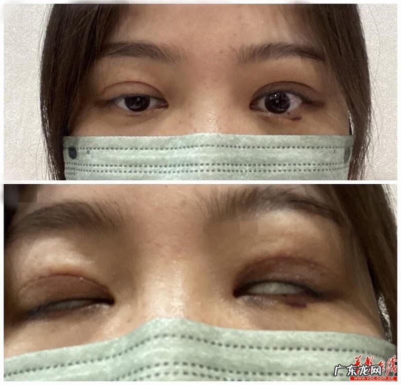 重庆星艺美整形 长沙市艺星医疗整形