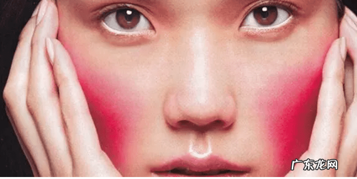 如何快速去掉脸上红血丝 怎样可以去除脸上红血丝