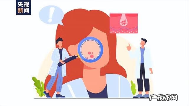 常见的肌肤问题形成的原因 常见肌肤问题