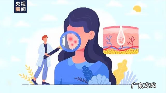 常见的肌肤问题形成的原因 常见肌肤问题