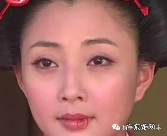 嘴角的痣点掉了还会影响运气吗 嘴唇上的痣风水