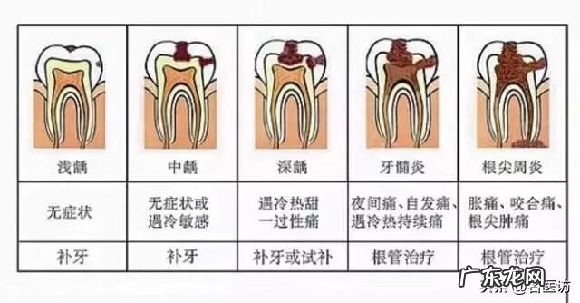 右边上面的牙齿痛 右边的牙齿痛