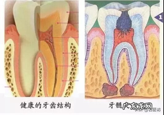 右边上面的牙齿痛 右边的牙齿痛