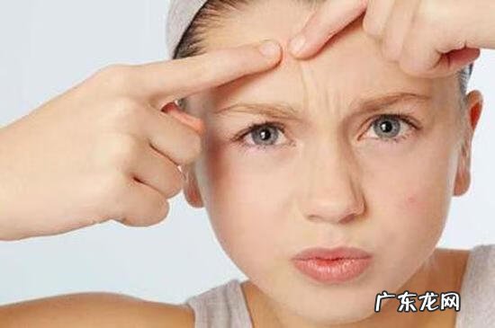 祛痘的方法 去痘最有效方法