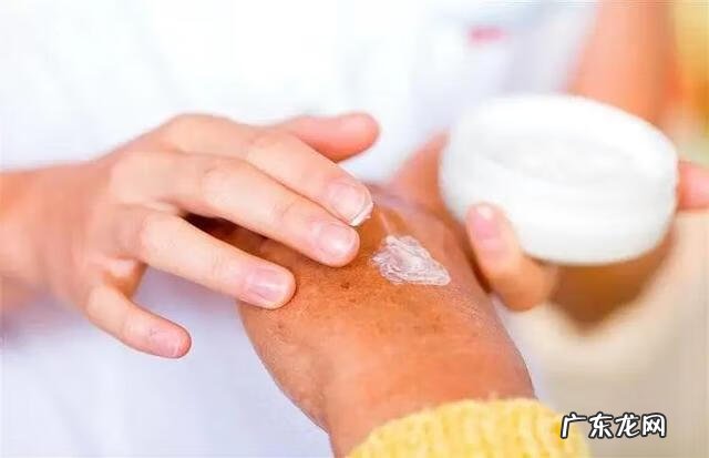 什么是接触性皮炎症状 接触性皮炎的症状表现