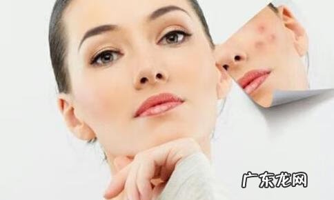 脸上长痘痘印怎么消除 痘印怎么去除最有效的方法