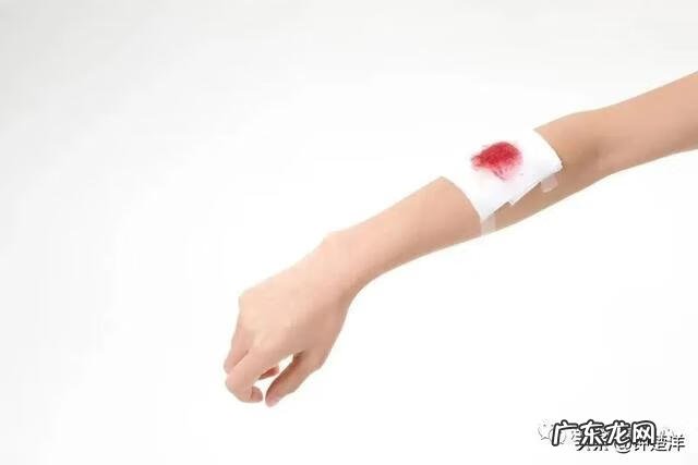 运动损伤那些事 运动损伤的处理方法