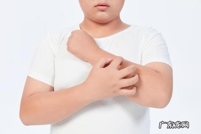 干性湿疹是怎样引起的 干性湿疹是什么原因引起的