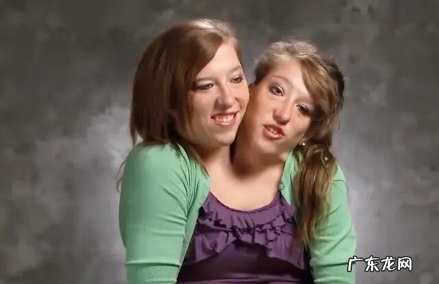 双头美女人 双头人姐妹