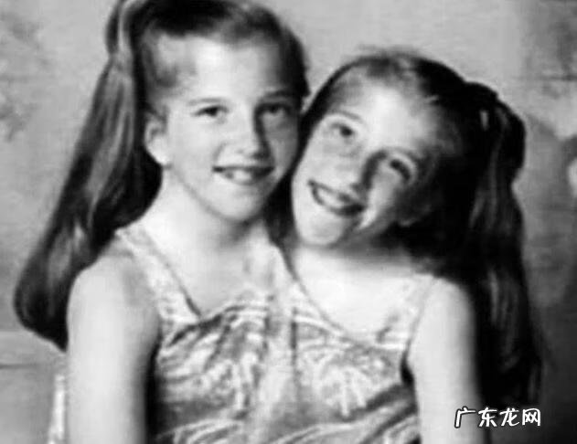 双头美女人 双头人姐妹