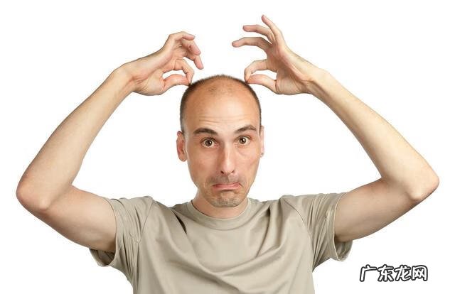 男人秃顶是什么原因 男人秃顶的原因