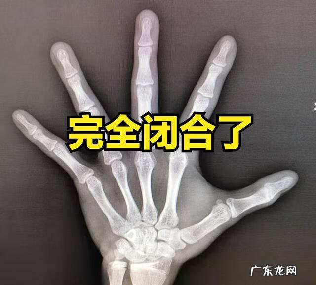 男孩变声后还能长高几厘米 男孩变声后还会长高吗