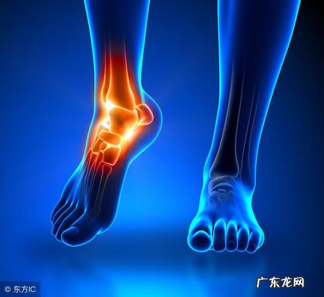 脚踝浮肿手按有凹陷 脚踝浮肿是什么原因