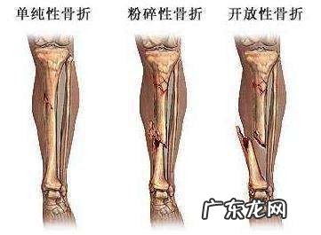脑部疾病的风水调理 脑瘫病人的风水