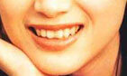 牙齿是风水吗 牙齿的风水讲究
