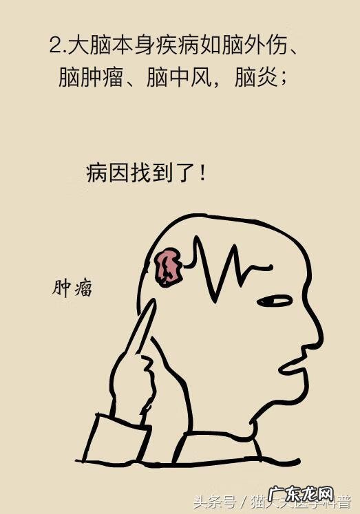 癫疯病是怎么引起 癫痫病是怎么回事