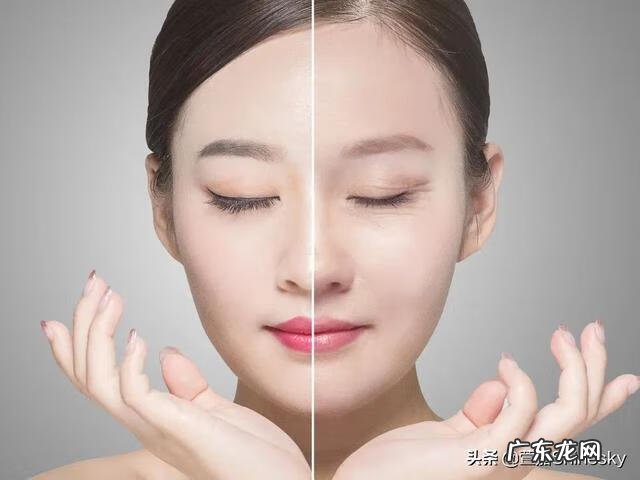 眼睛周边长细纹了怎么办 眼睛长细纹怎么办呢