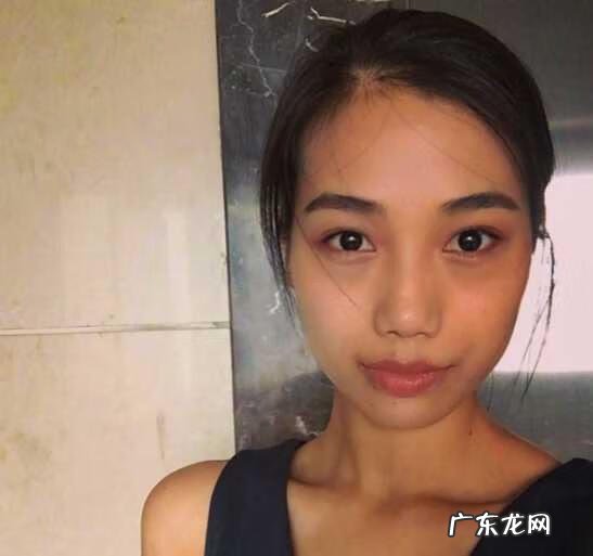 皮肤暗沉很严重 皮肤暗沉怎么解决