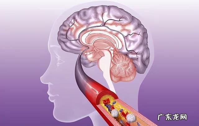 手指一阵一阵的发麻 手指头发麻是什么情况