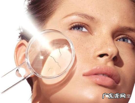 儿童雀斑怎么去除方法 怎样祛除雀斑